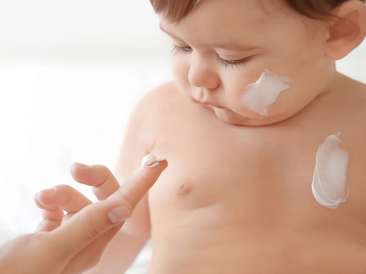 Bebé con dermatitis o alergia cutánea - Alergología pediátrica